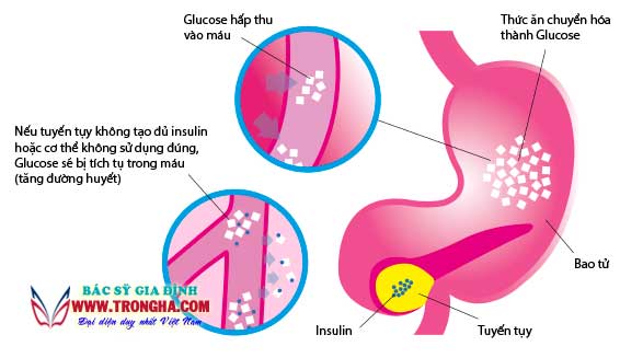 chuyển hóa insulin