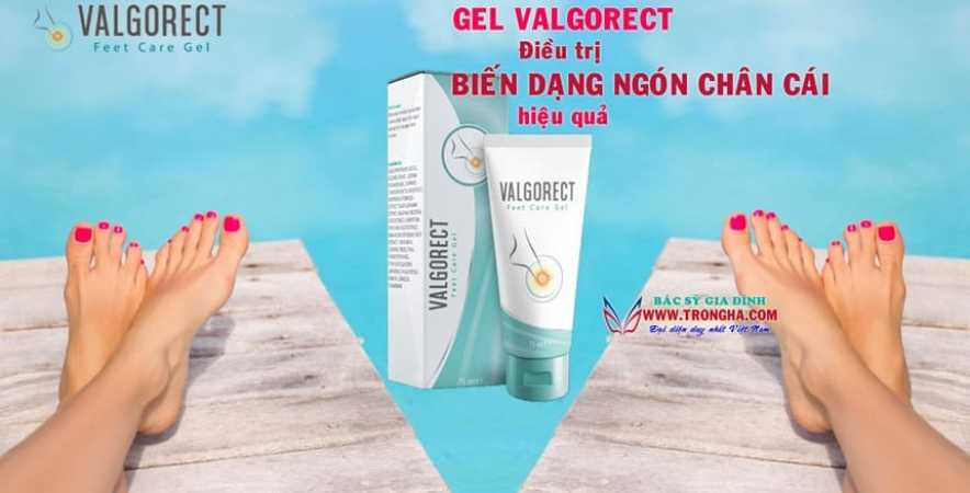 Gel Valgorect điều trị biến dạng ngón chân cái hiệu quả
