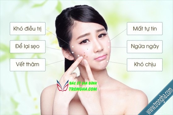 Princess Mask mặt nạ lột mụn - làm sạch bụi bẩn